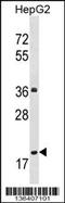 Protein phosphatase 1M antibody, 58-819, ProSci, Western Blot image 