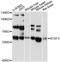Acyl-CoA Synthetase Family Member 3 antibody, LS-C748798, Lifespan Biosciences, Western Blot image 