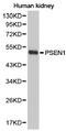 Presenilin 1 antibody, LS-C193097, Lifespan Biosciences, Western Blot image 