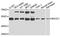 Beta-Secretase 1 antibody, A5266, ABclonal Technology, Western Blot image 
