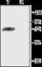 Potassium Voltage-Gated Channel Subfamily D Member 3 antibody, GTX16642, GeneTex, Western Blot image 