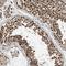 Protein SCAI antibody, HPA020632, Atlas Antibodies, Immunohistochemistry frozen image 