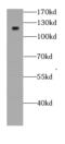 Sickle tail protein homolog antibody, FNab04542, FineTest, Western Blot image 