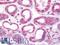 Phosphofructokinase, Platelet antibody, LS-B10910, Lifespan Biosciences, Immunohistochemistry paraffin image 