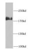 Rho GTPase Activating Protein 5 antibody, FNab00553, FineTest, Western Blot image 