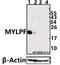 Myosin regulatory light chain 2, skeletal muscle isoform antibody, A11730, Boster Biological Technology, Western Blot image 