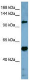 Cordon-Bleu WH2 Repeat Protein Like 1 antibody, TA344107, Origene, Western Blot image 