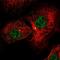 Zinc Finger Protein 341 antibody, NBP1-84219, Novus Biologicals, Immunocytochemistry image 