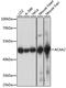 3-ketoacyl-CoA thiolase, mitochondrial antibody, A15778, ABclonal Technology, Western Blot image 