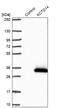 Potassium Channel Tetramerization Domain Containing 14 antibody, NBP1-92042, Novus Biologicals, Western Blot image 