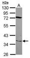 Solute Carrier Family 25 Member 28 antibody, GTX121316, GeneTex, Western Blot image 