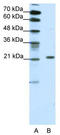 Chromobox 1 antibody, TA335673, Origene, Western Blot image 