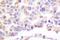 Phospholipase A2 Group IVA antibody, LS-C192155, Lifespan Biosciences, Immunohistochemistry paraffin image 