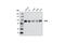 Dishevelled Segment Polarity Protein 3 antibody, 3218S, Cell Signaling Technology, Western Blot image 