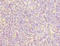 Zinc Finger Protein 131 antibody, A63808-100, Epigentek, Immunohistochemistry paraffin image 