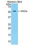 Trefoil Factor 3 antibody, LS-C372789, Lifespan Biosciences, Western Blot image 