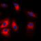Heat Shock Protein Family A (Hsp70) Member 5 antibody, orb375919, Biorbyt, Immunofluorescence image 