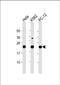 Leucine Zipper And CTNNBIP1 Domain Containing antibody, PA5-72014, Invitrogen Antibodies, Western Blot image 