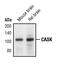 Calcium/Calmodulin Dependent Serine Protein Kinase antibody, PA5-17433, Invitrogen Antibodies, Western Blot image 