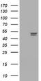 Thymidine Phosphorylase antibody, TA801109BM, Origene, Western Blot image 
