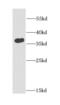 FKBP Prolyl Isomerase 6 antibody, FNab03146, FineTest, Western Blot image 