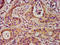 Secreted frizzled-related protein 5 antibody, LS-C671610, Lifespan Biosciences, Immunohistochemistry paraffin image 