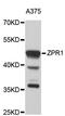 Zinc finger protein ZPR1 antibody, STJ26154, St John