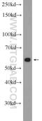 Sestrin 3 antibody, 24532-1-AP, Proteintech Group, Western Blot image 