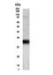 Four And A Half LIM Domains 5 antibody, NBP2-27588, Novus Biologicals, Western Blot image 