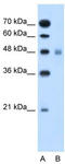 Solute Carrier Family 17 Member 4 antibody, TA333941, Origene, Western Blot image 