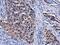 Deoxycytidine kinase antibody, MA5-27740, Invitrogen Antibodies, Immunohistochemistry frozen image 