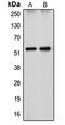 Cytochrome P450 Family 26 Subfamily A Member 1 antibody, MBS822084, MyBioSource, Western Blot image 