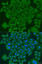 NADH:Ubiquinone Oxidoreductase Core Subunit S7 antibody, 23-234, ProSci, Immunofluorescence image 