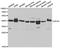 Uroporphyrinogen Decarboxylase antibody, STJ27446, St John