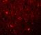 Sushi Repeat Containing Protein X-Linked antibody, NBP1-77086, Novus Biologicals, Immunocytochemistry image 