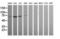 ETS Transcription Factor ERG antibody, LS-C174669, Lifespan Biosciences, Western Blot image 