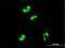 MRT4 Homolog, Ribosome Maturation Factor antibody, H00051154-M01, Novus Biologicals, Immunocytochemistry image 