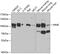 Membrane Metalloendopeptidase antibody, GTX32493, GeneTex, Western Blot image 
