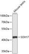 SRY-Box 17 antibody, 13-493, ProSci, Western Blot image 