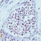 X-Ray Repair Cross Complementing 1 antibody, LS-C87491, Lifespan Biosciences, Immunohistochemistry paraffin image 