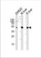 Ornithine Carbamoyltransferase antibody, TA324880, Origene, Western Blot image 