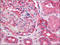 ATM Serine/Threonine Kinase antibody, AM06035PU-N, Origene, Immunohistochemistry frozen image 