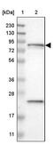 Holocarboxylase Synthetase antibody, PA5-53599, Invitrogen Antibodies, Western Blot image 