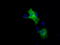 B-Raf Proto-Oncogene, Serine/Threonine Kinase antibody, TA500852, Origene, Immunofluorescence image 
