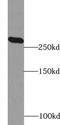 Acetyl-CoA Carboxylase Alpha antibody, FNab00077, FineTest, Western Blot image 