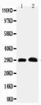 Aquaporin 5 antibody, PA1230, Boster Biological Technology, Western Blot image 