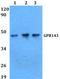 G Protein-Coupled Receptor 143 antibody, PA5-75760, Invitrogen Antibodies, Western Blot image 