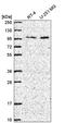 ZXD Family Zinc Finger C antibody, HPA049593, Atlas Antibodies, Western Blot image 