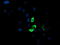 Glutamyl Aminopeptidase antibody, M06961-1, Boster Biological Technology, Immunofluorescence image 