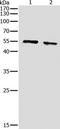 Protein kinase B antibody, TA321682, Origene, Western Blot image 